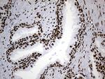 HNRNPH1 Antibody in Immunohistochemistry (Paraffin) (IHC (P))