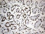 HNRNPH1 Antibody in Immunohistochemistry (Paraffin) (IHC (P))