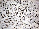 HNRNPH1 Antibody in Immunohistochemistry (Paraffin) (IHC (P))