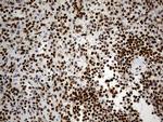 HNRNPH1 Antibody in Immunohistochemistry (Paraffin) (IHC (P))