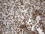 HNRNPH1 Antibody in Immunohistochemistry (Paraffin) (IHC (P))