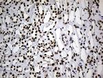 HNRNPH1 Antibody in Immunohistochemistry (Paraffin) (IHC (P))