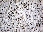 HNRNPH1 Antibody in Immunohistochemistry (Paraffin) (IHC (P))