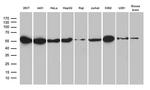 HNRNPH1 Antibody in Western Blot (WB)