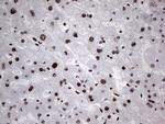 HNRNPL Antibody in Immunohistochemistry (Paraffin) (IHC (P))