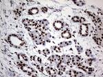 HNRNPL Antibody in Immunohistochemistry (Paraffin) (IHC (P))