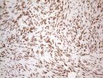 HNRNPL Antibody in Immunohistochemistry (Paraffin) (IHC (P))