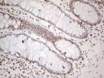 HNRNPL Antibody in Immunohistochemistry (Paraffin) (IHC (P))