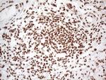 HNRNPL Antibody in Immunohistochemistry (Paraffin) (IHC (P))