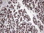 HNRNPL Antibody in Immunohistochemistry (Paraffin) (IHC (P))