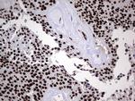 HNRNPL Antibody in Immunohistochemistry (Paraffin) (IHC (P))