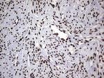 HNRNPL Antibody in Immunohistochemistry (Paraffin) (IHC (P))