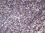 HNRNPL Antibody in Immunohistochemistry (Paraffin) (IHC (P))