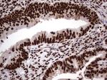 HNRNPL Antibody in Immunohistochemistry (Paraffin) (IHC (P))