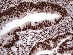 HNRNPL Antibody in Immunohistochemistry (Paraffin) (IHC (P))