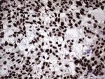 HNRNPL Antibody in Immunohistochemistry (Paraffin) (IHC (P))