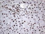 HNRNPL Antibody in Immunohistochemistry (Paraffin) (IHC (P))