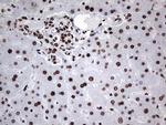 HNRNPL Antibody in Immunohistochemistry (Paraffin) (IHC (P))