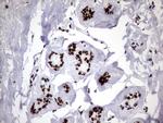 HNRNPM Antibody in Immunohistochemistry (Paraffin) (IHC (P))