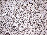 HNRNPM Antibody in Immunohistochemistry (Paraffin) (IHC (P))