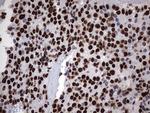 HNRNPM Antibody in Immunohistochemistry (Paraffin) (IHC (P))