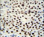 hnRNP AB Antibody in Immunohistochemistry (IHC)
