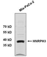 hnRNP H3 Antibody in Western Blot (WB)