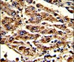 HOMER1 Antibody in Immunohistochemistry (IHC)