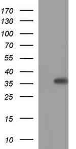HORMAD2 Antibody in Western Blot (WB)