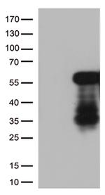 HOXA2 Antibody in Western Blot (WB)