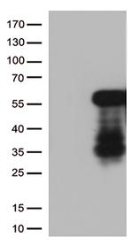 HOXA2 Antibody in Western Blot (WB)