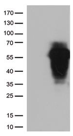 HOXA2 Antibody in Western Blot (WB)