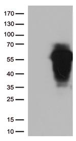 HOXA2 Antibody in Western Blot (WB)