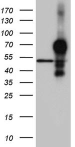 HOXA3 Antibody in Western Blot (WB)