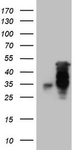 HOXC10 Antibody in Western Blot (WB)