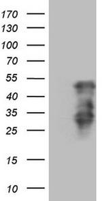 HOXC10 Antibody in Western Blot (WB)