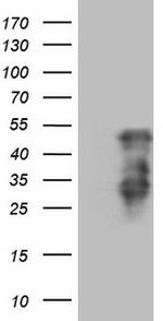HOXC10 Antibody in Western Blot (WB)