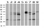 HOXC11 Antibody in Western Blot (WB)