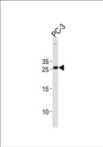 HOXC6 Antibody in Western Blot (WB)