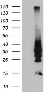 HOXD4 Antibody in Western Blot (WB)