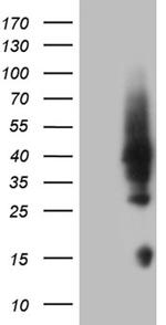 HOXD4 Antibody in Western Blot (WB)