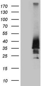 HOXD4 Antibody in Western Blot (WB)