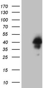 HOXD4 Antibody in Western Blot (WB)