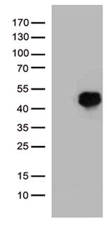 HOXD8 Antibody in Western Blot (WB)