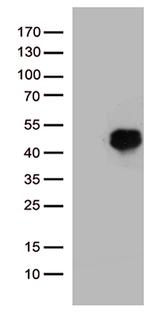 HOXD8 Antibody in Western Blot (WB)