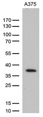 HOXD8 Antibody in Western Blot (WB)