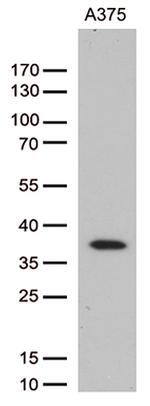 HOXD8 Antibody in Western Blot (WB)