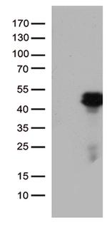 HOXD8 Antibody in Western Blot (WB)