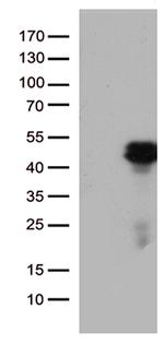 HOXD8 Antibody in Western Blot (WB)