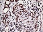 HOXD9 Antibody in Immunohistochemistry (Paraffin) (IHC (P))